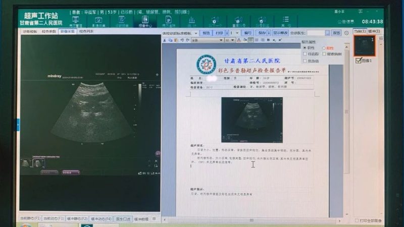 备孕体检项目清单包括哪些检查